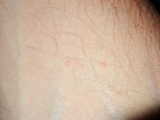 Some Kind Of Bite