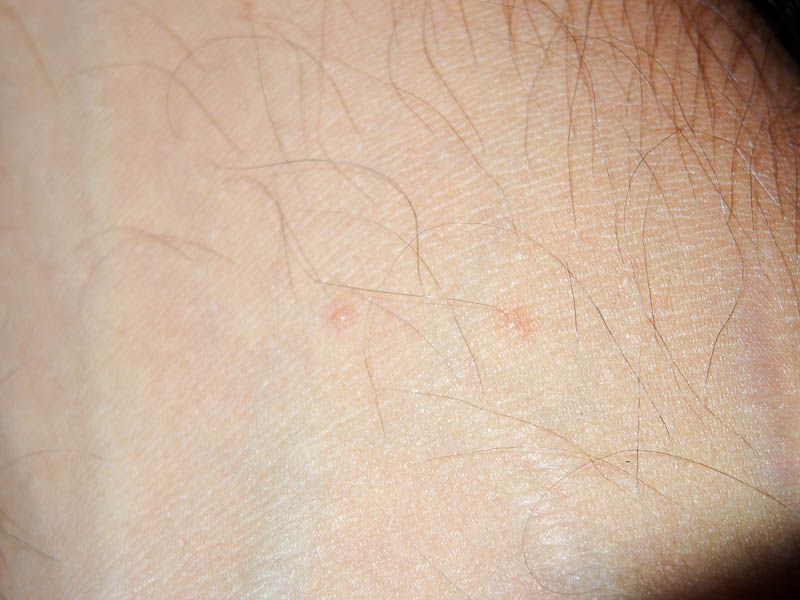 Some Kind Of Bite